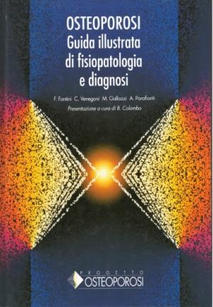 OSTEOPOROSI